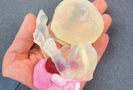 3d printed fetus model in hand