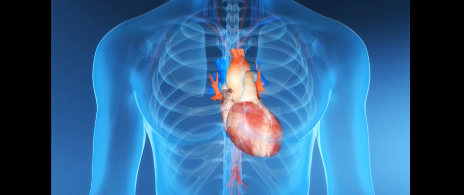 CDI Implant Empower Trial