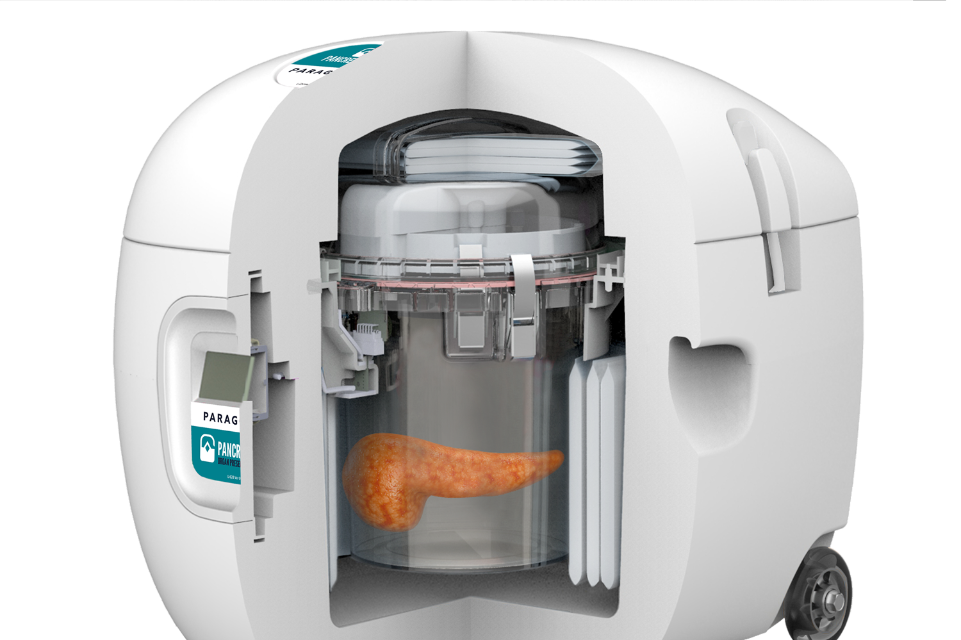 TGH Performs Transplant with First-in-Human Pancreas Preservation Technology