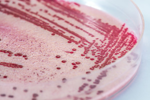 Listeria bacteria in petri dish