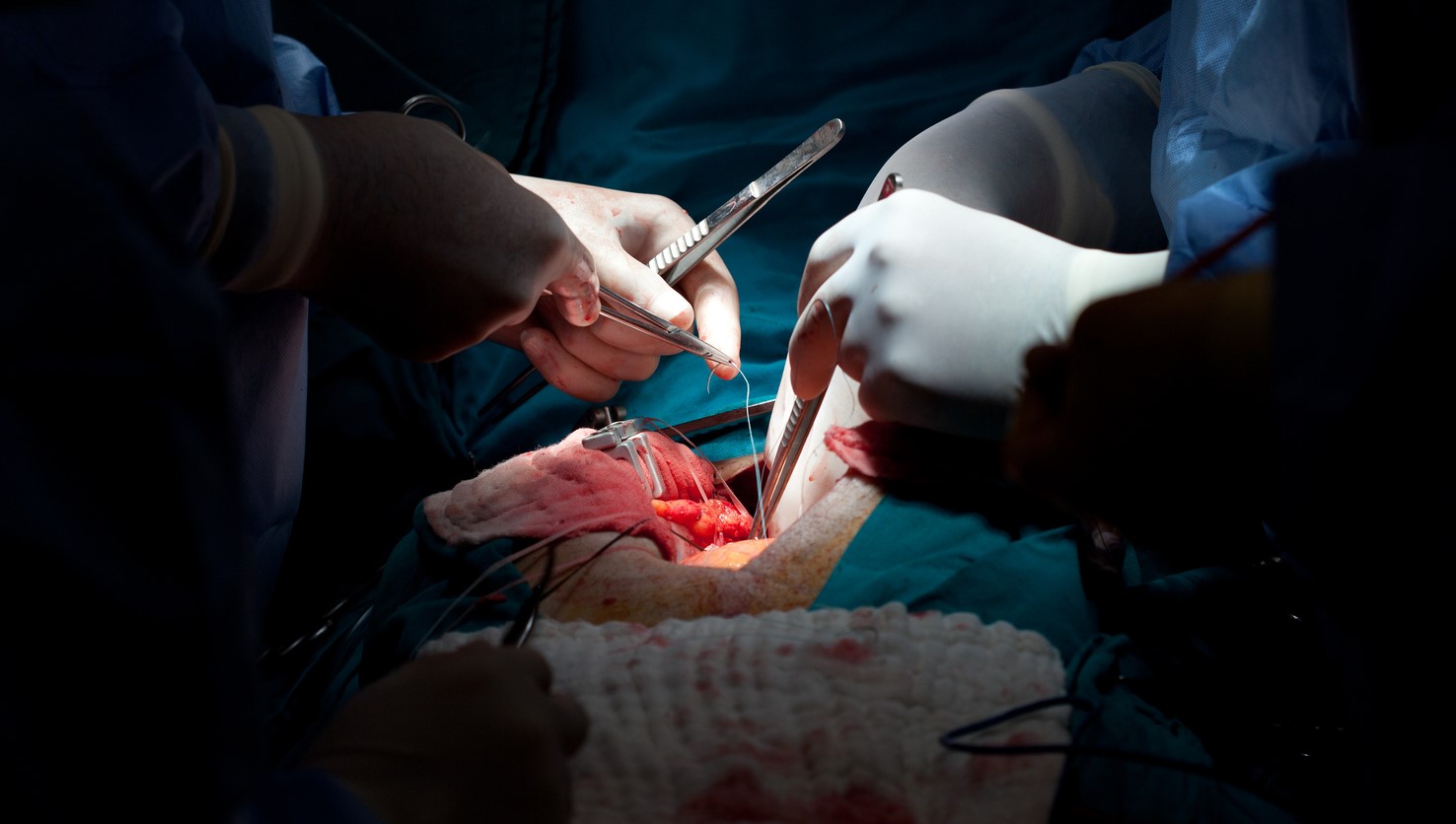 TGH Offers Patients Breakthrough Cardiothoracic Surgery Procedure