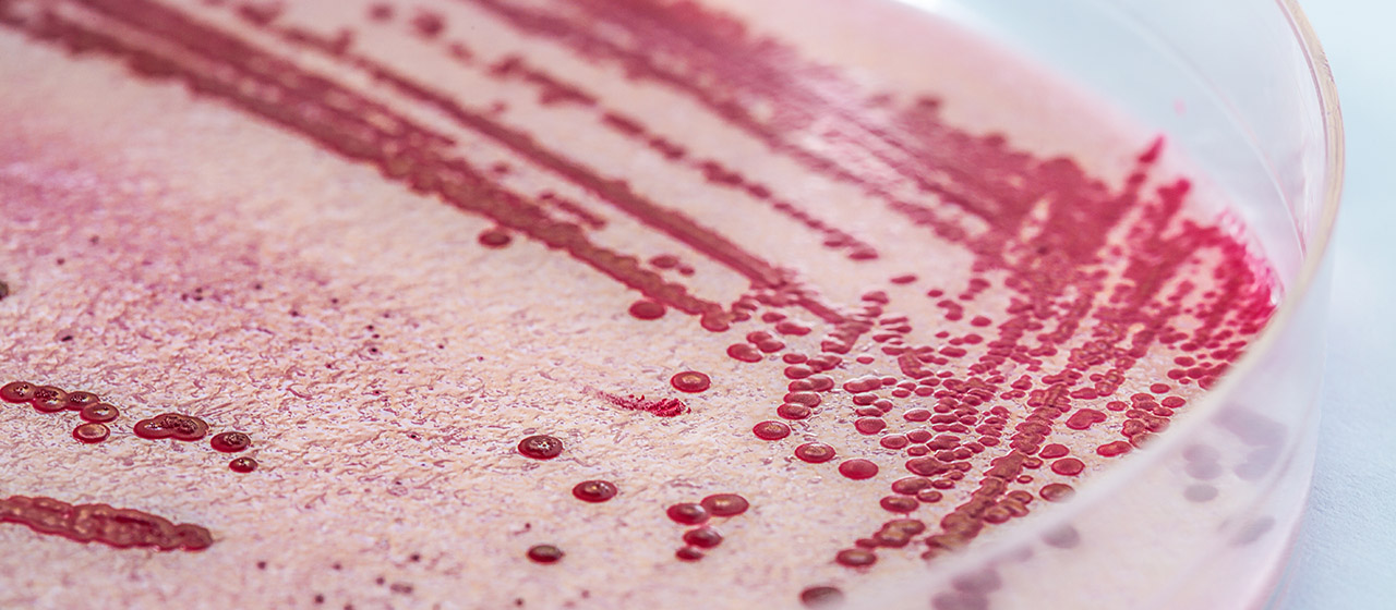 shutterstock_162665861_listeria